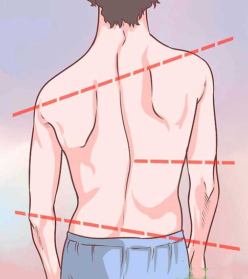 illustration of uneven posture